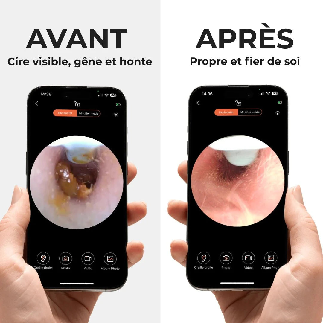 Earo Vision 2.0