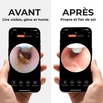 Earo Vision 2.0